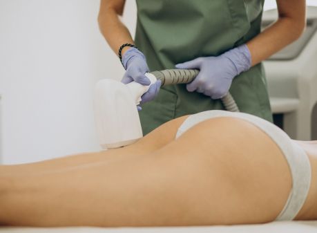 Sesión de HIFU para el cuerpo Foto de la cara de una mujer antes y después de un tratamiento dermapen en Girona